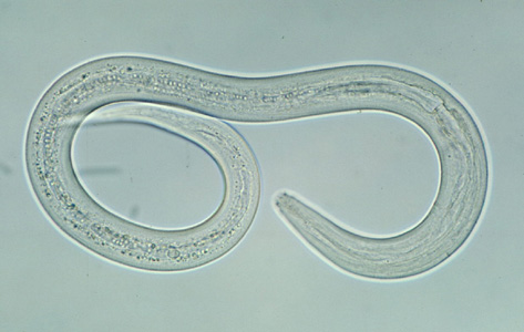 Roundworms Are What Type of Biohazard
