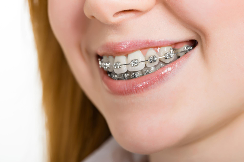 Orthodontic