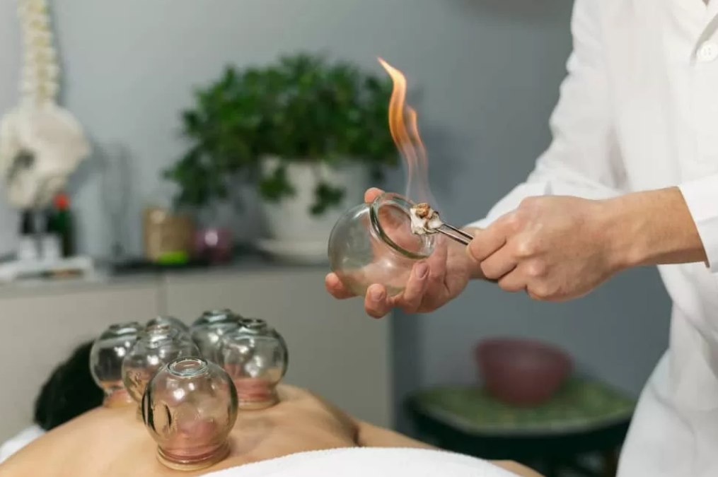 dry cupping therapy