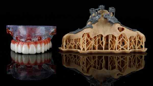 Dental implant