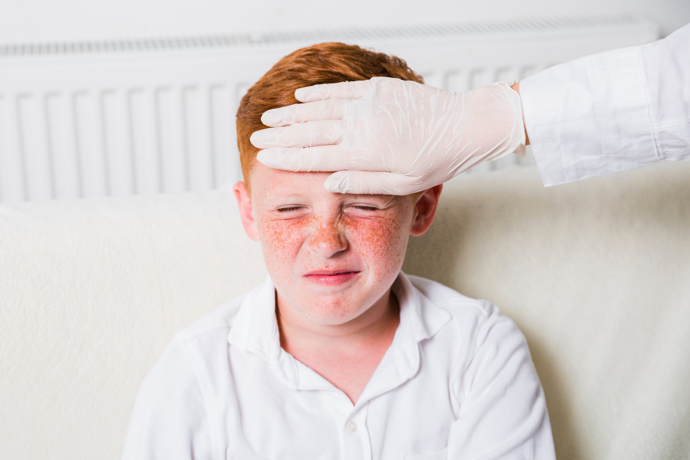 OCD and dermatillomania