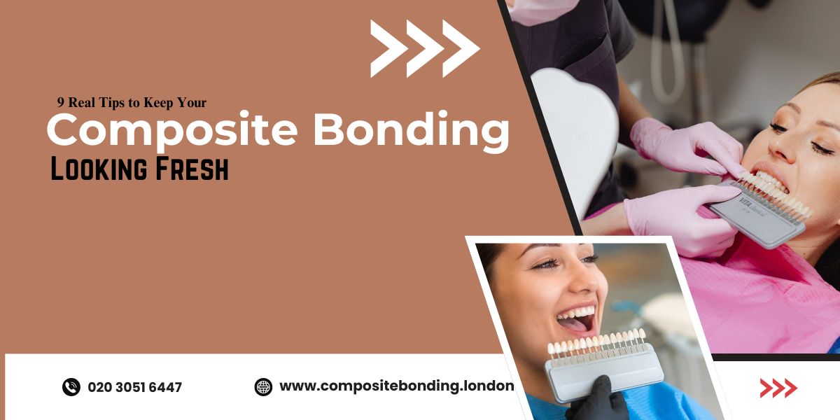 composite bonding cost UK prices