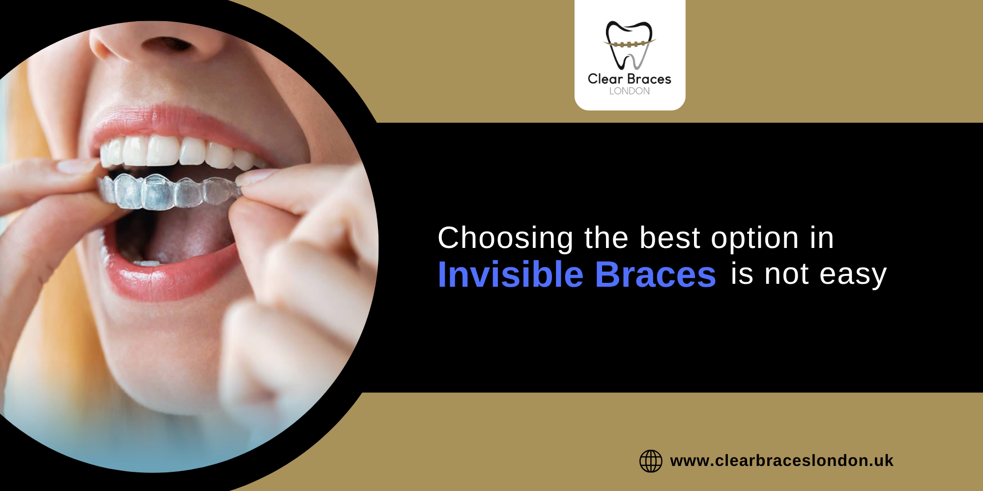 Choosing the best option in invisible braces is not easy