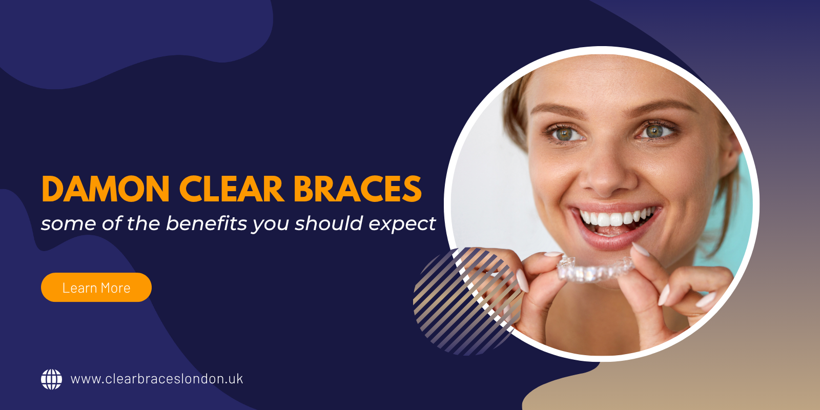 Damon clear braces – some of the benefits you should expect