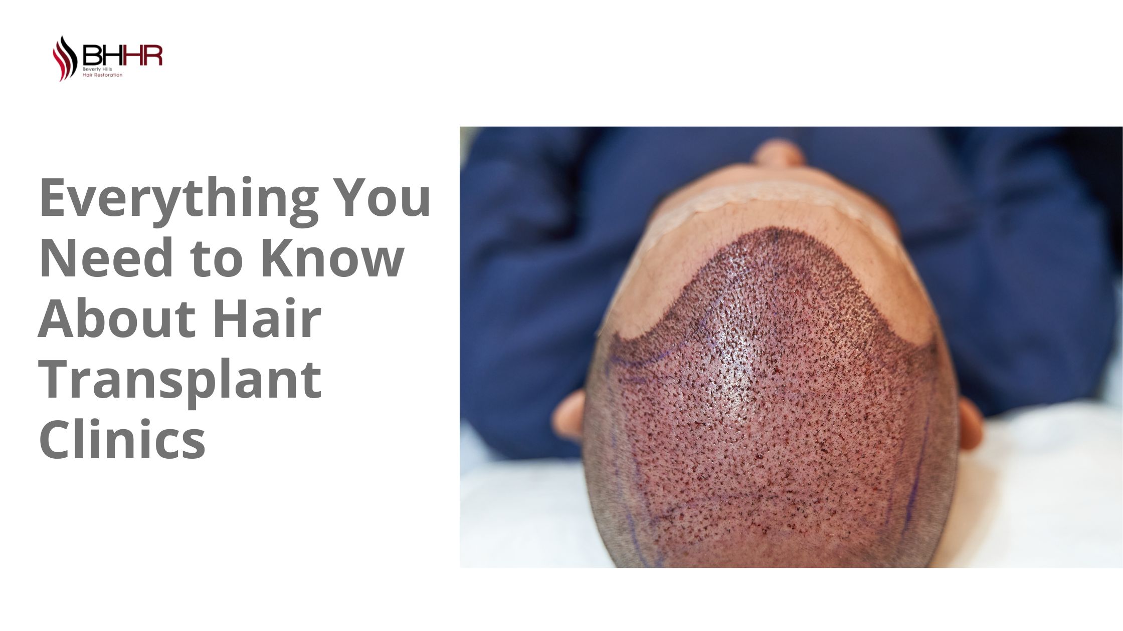 hair transplant clinic