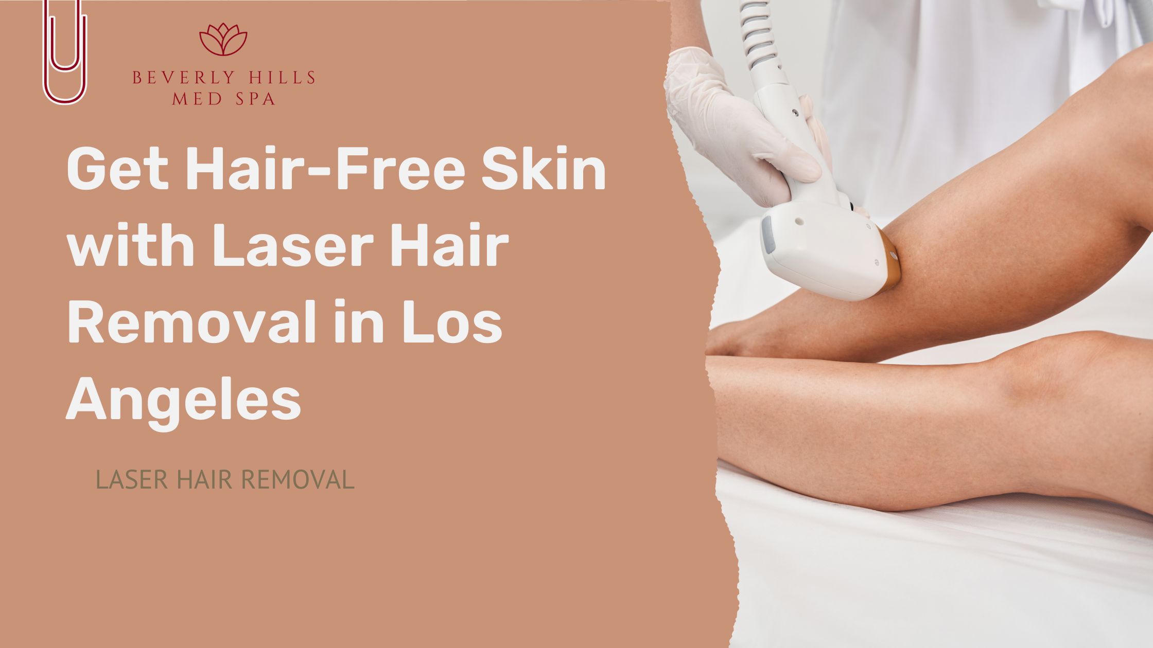 laser hair removal los angeles