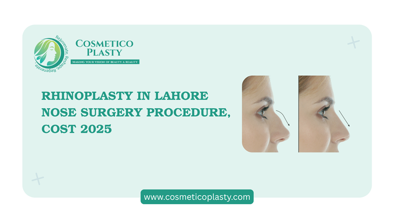 Rhinoplasty in Lahore