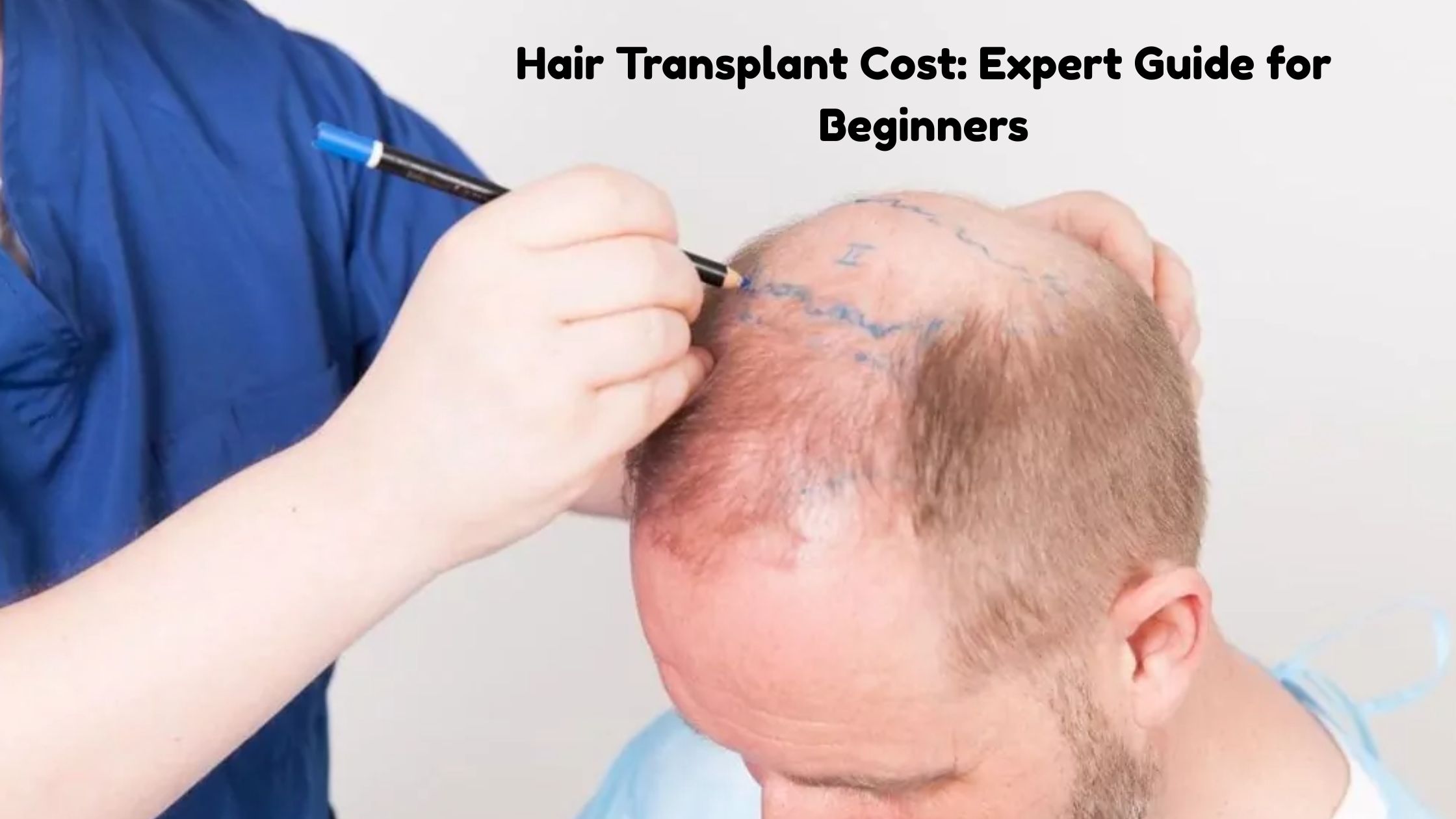 hair transplant cost