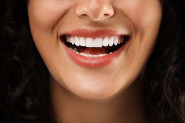 invisalign 
